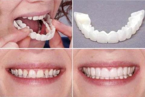 Denwhite®: Carillas Dentales Ajustables - Set 2 Pzs (Superior e inferior)