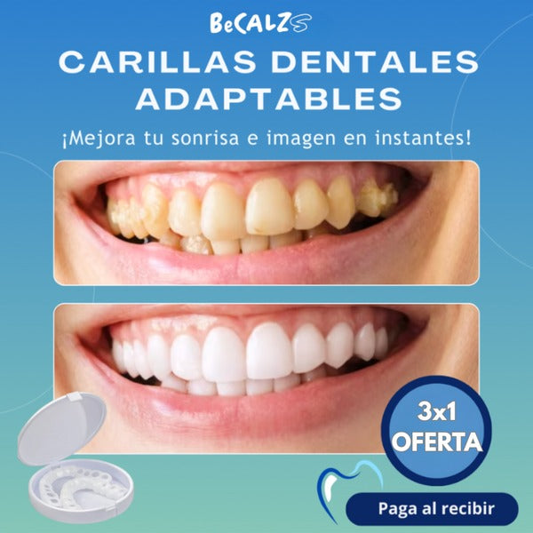 Denwhite®: Carillas Dentales Ajustables - Set 2 Pzs (Superior e inferior)