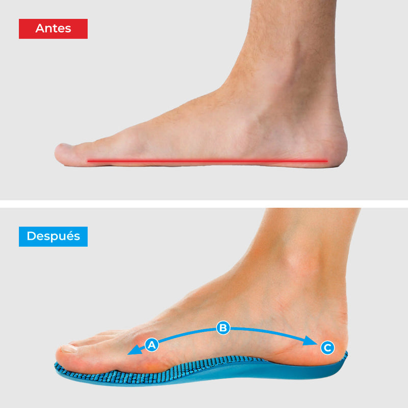 Plantillas ComfyFeet - Compra uno y llévate otro gratis + Calcetines ortopédicos
