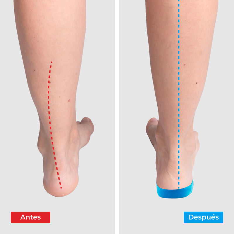 Plantillas ComfyFeet - Compra uno y llévate otro gratis + Calcetines ortopédicos